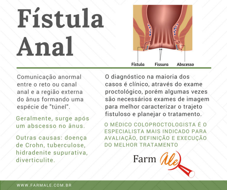 Fístula Anal Farmale 